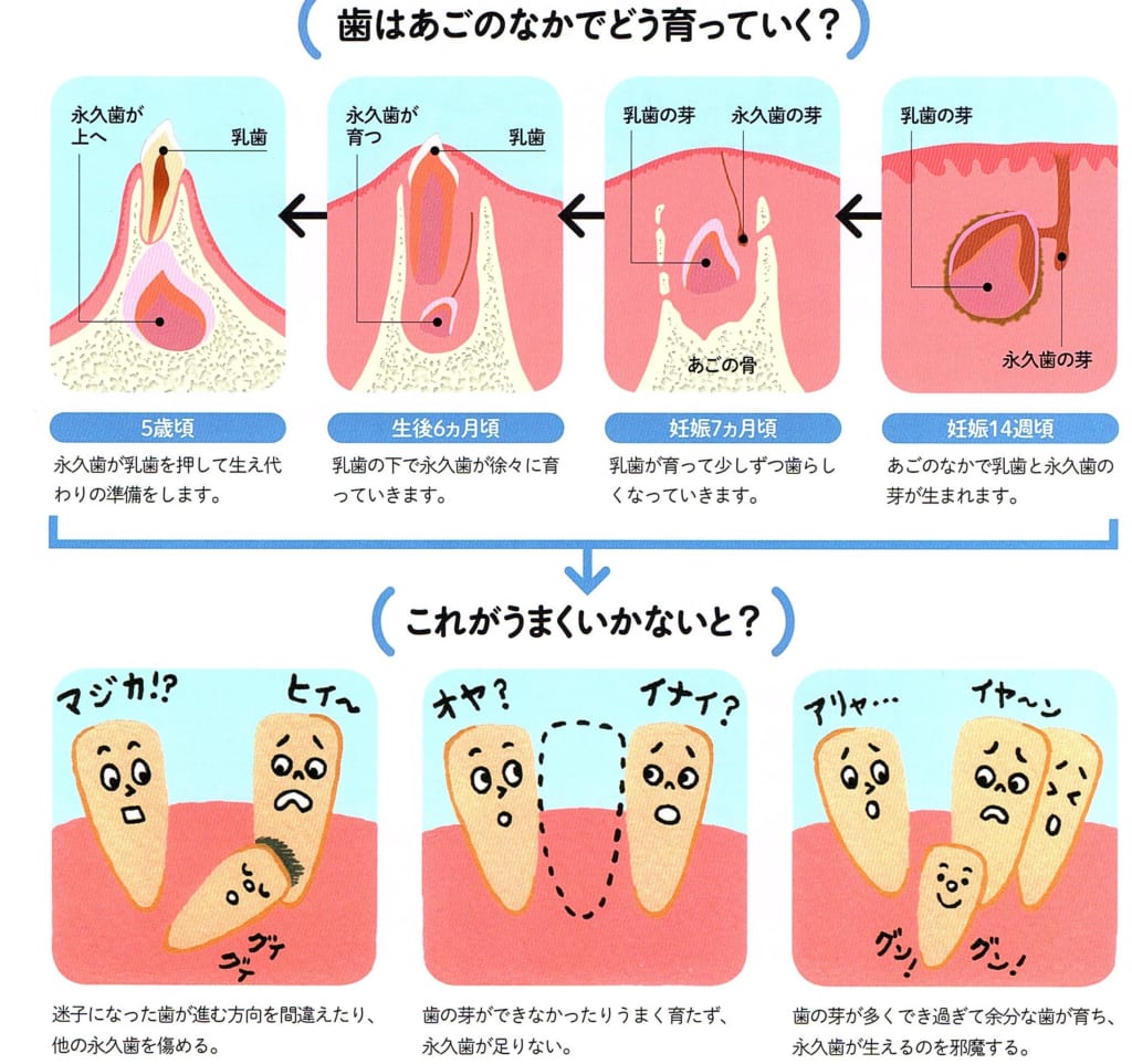 過剰歯と欠如歯 |村上歯科医院|北九州市小倉北区、大切な歯を守る「予防歯科」に力を入れています